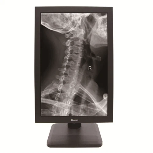 19.6 ইঞ্চি গ্রেস্কেল 2 এম মেডিকেল মনিটর